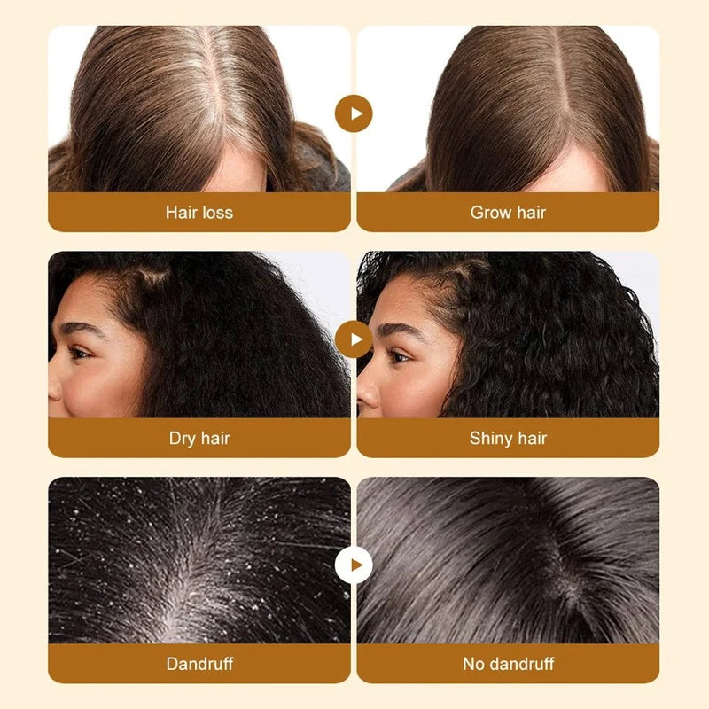 Batana Hair Oil – Natural Scalp & Hair Strengthening Oil for Nourishment, Smoothness & Healthy-Looking Hair
