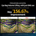 Dr. Melaxin Eyephalt Eye Cream – Under Eye Cream for Eye Bags, Dark Circles, Puffiness & Fine Lines | Brightening Eye Treatment