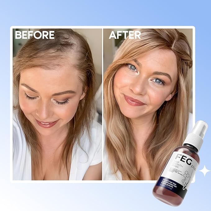FEG Plus Hair Growth Spray – Scalp Care & Hair Strengthening Treatment