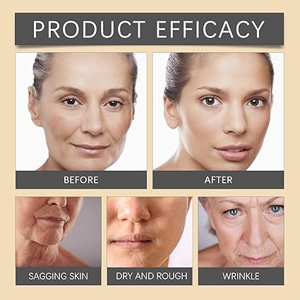 Bee Venom Eye Cream – Anti-Wrinkle & Firming Eye Treatment, Botox-Like Smoothing Effect