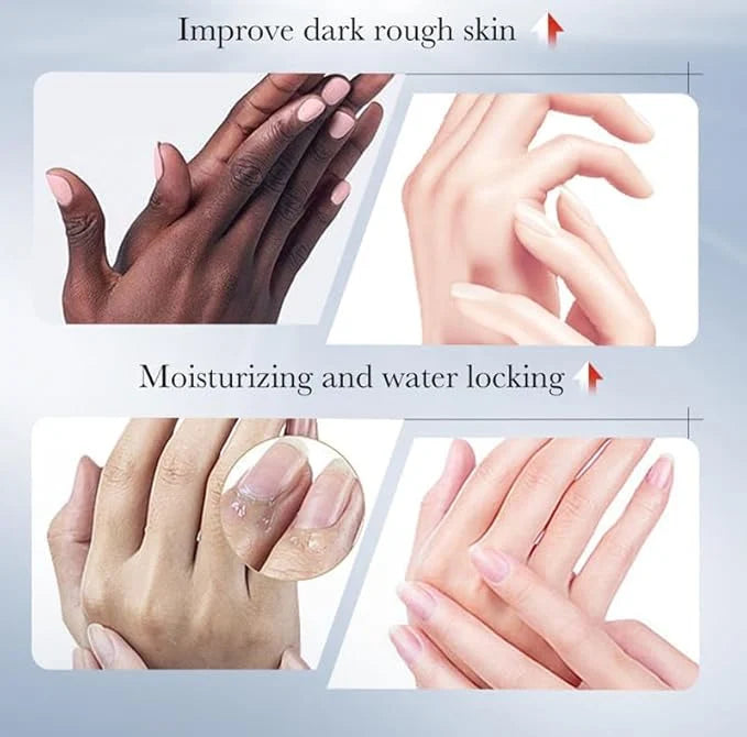 SADOER Kojic Acid Hand Cream for Dry Skin – Deep Moisturizing Hand Repair Cream for Soft, Smooth & Hydrated Hands