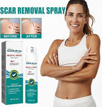 South Moon Scar Spray – Scar Care & Skin Repair Spray