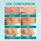 South Moon Scar Spray – Scar Care & Skin Repair Spray