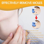 Tag Recede Bee Venom Repair Spray – Skin Tag & Wart Removal Treatment with Bee Venom, Botanical Extracts & Skin Repair Formula