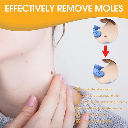 Tag Recede Bee Venom Repair Spray – Skin Tag & Wart Removal Treatment with Bee Venom, Botanical Extracts & Skin Repair Formula